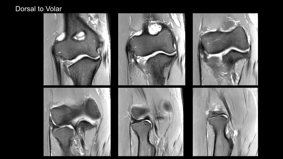 Figure 3 for case Volar dislocation of the radial head
